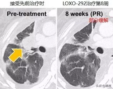 91破解:网友热议其安全性与实用性,是否真的能满足用户需求?你怎么看待这个工具的使用效果? 91破解:网友热议其安全性与实用性,是否真的能满足用户需求?你怎么看待这个工具的使用效果?