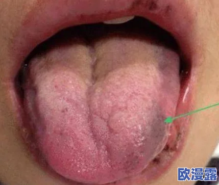 舌头探洞水好多怎么办?专家教你如何应对这一奇怪现象,保护口腔健康! 舌头探洞水好多怎么办?专家教你如何应对这一奇怪现象,保护口腔健康!
