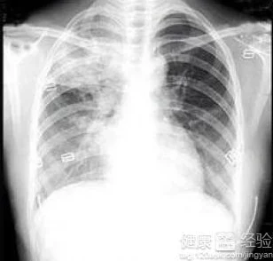 强亲胸揉胸膜下刺激视频在线观看最新进展消息显示该领域的研究正在不断深入，相关技术和应用前景备受关注与期待